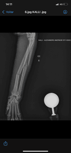 CIRURGIA KALLI - Cirurgia Kalli