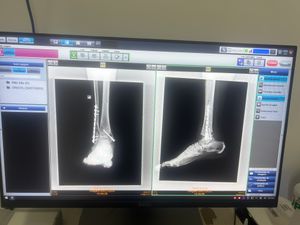 Saúde e Emergências - Eu Marcos Vinicius peço a ajuda de vcs , pois estou desempregado com família e sem condições de trabalhar devido está em situação complicada após ter caído da laje a trabalho . 