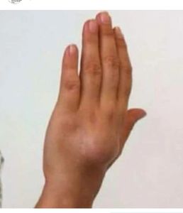 São Paulo/SP - Ajude Paula (Câncer raro)