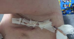 Ajude Paula (Câncer raro) imagem 9