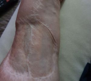 Ajude Paula (Câncer raro) imagem 7