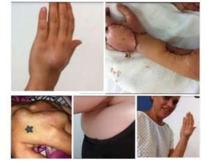 Vaquinha Online - Ajude Paula (Câncer raro)