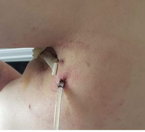 Ajude Paula (Câncer raro) imagem 8