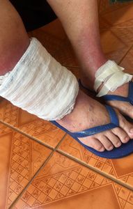 Vaquinha Online - Cirurgia da Dona Maria