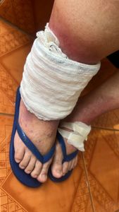 Saúde e Emergências - Cirurgia da Dona Maria