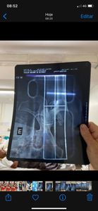 Brasília/DF - Ajude a Dona Ruth