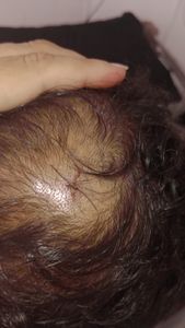 Vaquinha Online - Gil pai de autista Severo que sofreu assalto perdeu seu carro e tentativa de homicídio