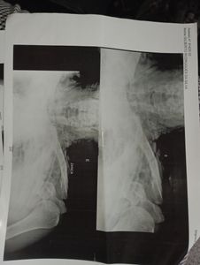 Gil pai de autista Severo que sofreu assalto perdeu seu carro e tentativa de homicídio imagem 10