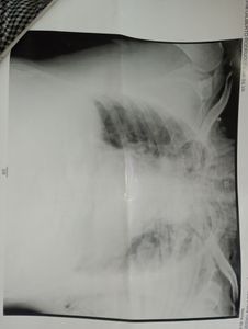 Gil pai de autista Severo que sofreu assalto perdeu seu carro e tentativa de homicídio imagem 9