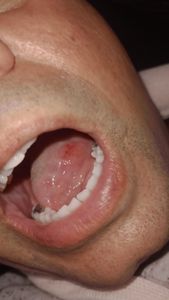 Saúde e Emergências - Gil pai de autista Severo que sofreu assalto perdeu seu carro e tentativa de homicídio