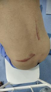 Gil pai de autista Severo que sofreu assalto perdeu seu carro e tentativa de homicídio imagem 6