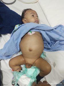 Vaquinha Online - Ajude  o Nicolas a continuar com a sua evolução 