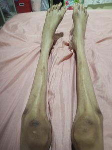 Tratamento e casa para Talita 