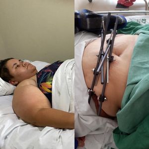 Vaquinha Online - Ajude Juliana Moraes