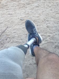 Vaquinha Online - Uma perna nova para o José