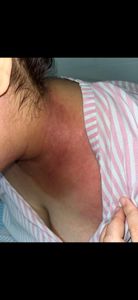 Vaquinha Online - TRATAMENTO DA ALERGIA