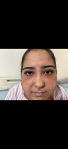 Saúde e Emergências - TRATAMENTO DA ALERGIA