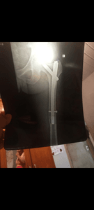 Ajude Rondielson a conseguir se manter nesse momento difícil que está passando sem poder trabalhar 