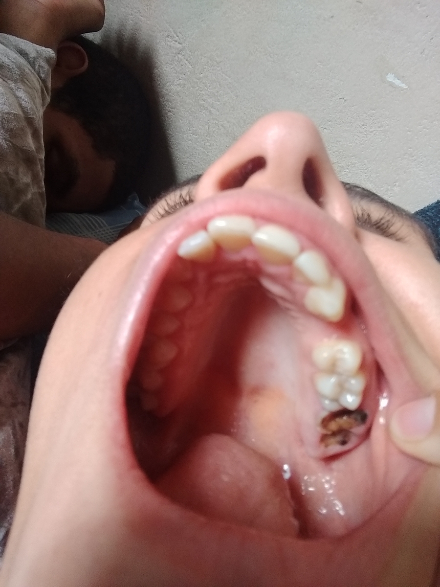 Barra do Piraí/RJ - Preciso de dentista urgente 