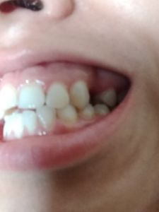 Dentista - Preciso de dentista urgente 