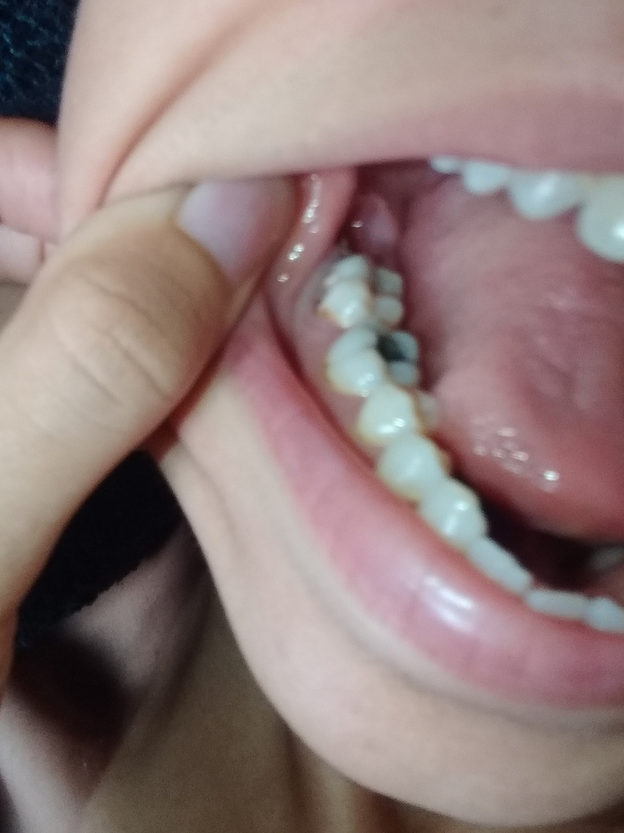 Vaquinha Online - Preciso de dentista urgente 