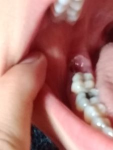 Saúde e Emergências - Preciso de dentista urgente 