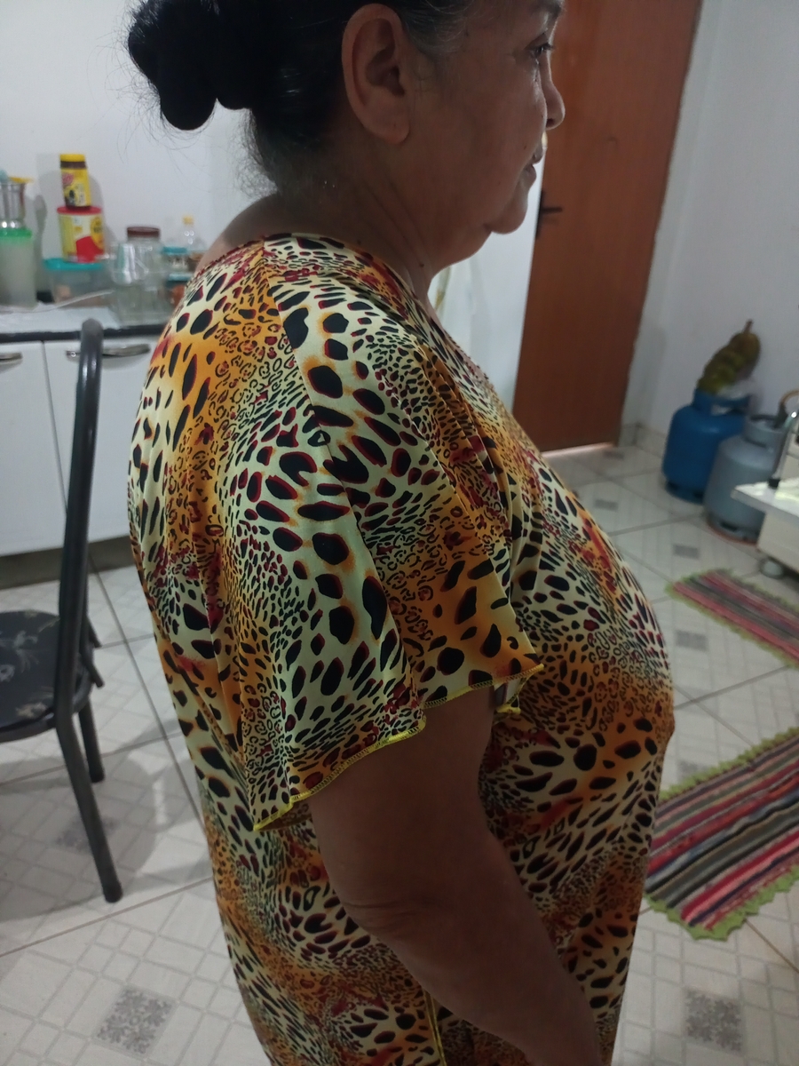 Vaquinha Online - Melhorar a postura da mamãe Nilza!