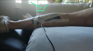 Unidos pela Cura : Ajude VELINE encontrar uma Solução - Unidos pela Cura: Ajude VELINE encontrar uma solução!