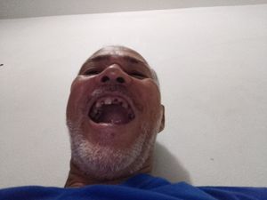 Saúde e Emergências - Próteses dentária 