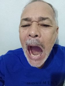 Vaquinha Online - Próteses dentária 