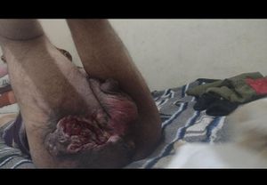 Vaquinha Online - VIVA ROBSON