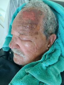 Vaquinha Online - Ajude o Sr. Otilio e a Dona Ivone a reconstruir o lar perdido no incêndio 