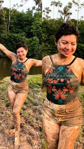 Tratamento com Lutécio-177 Radioativo. imagem 6