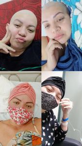 Santarém/PA - Tratamento com Lutécio-177 Radioativo.