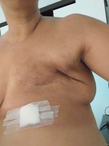 Lidiane Sabino  - Contribuição para custear serviços advocatícios para dar continuidade ao meu tratamento oncológico 