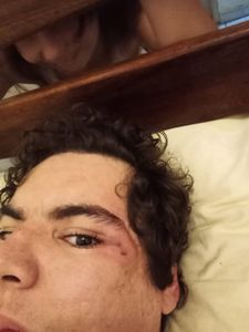 Campinas/SP - DISTROFIA MUSCULAR, por uma vida menos difícil