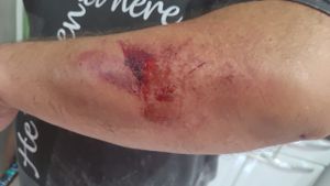 Irmãos preciso de ajuda em nome de Jesus - Preciso de ajuda, fui fechado e capotei com os passageiros!