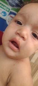 Vaquinha Online - Ajude essa criança que precisa