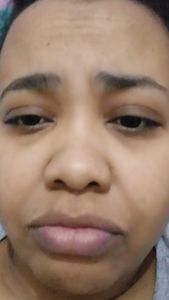 Rio de Janeiro/RJ - Urgente Dani precisa de Cirurgia no cérebro