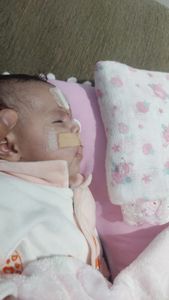 Vaquinha Online - Arrecadação de Fundo para as Cirurgias da Laura Gomes - Fenda Palatina, Correção, estética, etc.