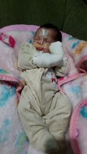 Cirurgias de Correção Lábios, Palato, Arcada Dentária - Laura Gomes Fernandes - Arrecadação de Fundo para as Cirurgias da Laura Gomes - Fenda Palatina, Correção, estética, etc.