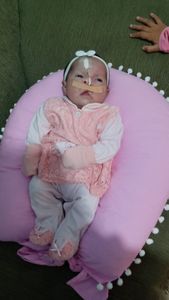 São Paulo/SP - Arrecadação de Fundo para as Cirurgias da Laura Gomes - Fenda Palatina, Correção, estética, etc.