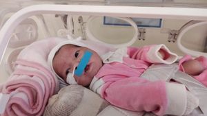 Arrecadação de Fundo para as Cirurgias da Laura Gomes - Fenda Palatina, Correção, estética, etc. imagem 7