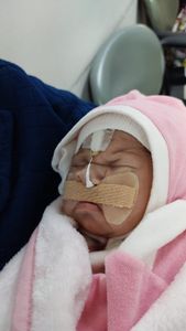 Arrecadação de Fundo para as Cirurgias da Laura Gomes - Fenda Palatina, Correção, estética, etc. imagem 8