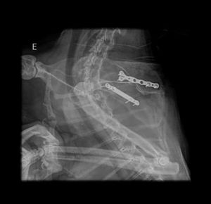 Vaquinha Online - Ajuda pra custear as despesas médicas da Shabyska 