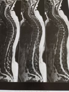 Vaquinha Online -  Cirurgia de Mamoplastia Redutora 