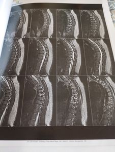 Saúde e Emergências -  Cirurgia de Mamoplastia Redutora 