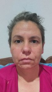 Me ajudem a descobrir meu diagnóstico 