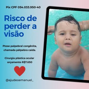 Canoas/RS - Cirurgia por risco de perder a visão, cirurgia plástica ocular - ptose palpebral congênita