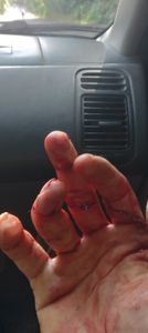 Vaquinha Online - Para judas meu tratamento e pagar alimentação e aluguel 